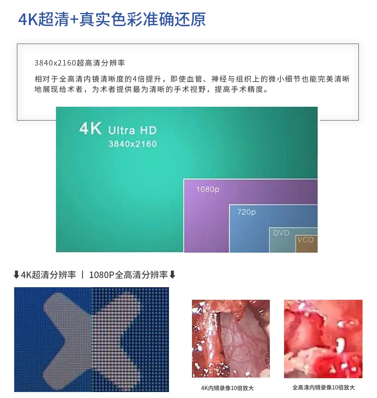 【4K醫(yī)用內(nèi)窺鏡攝像系統(tǒng)】您的第一臺(tái)“4K”找到了嗎？