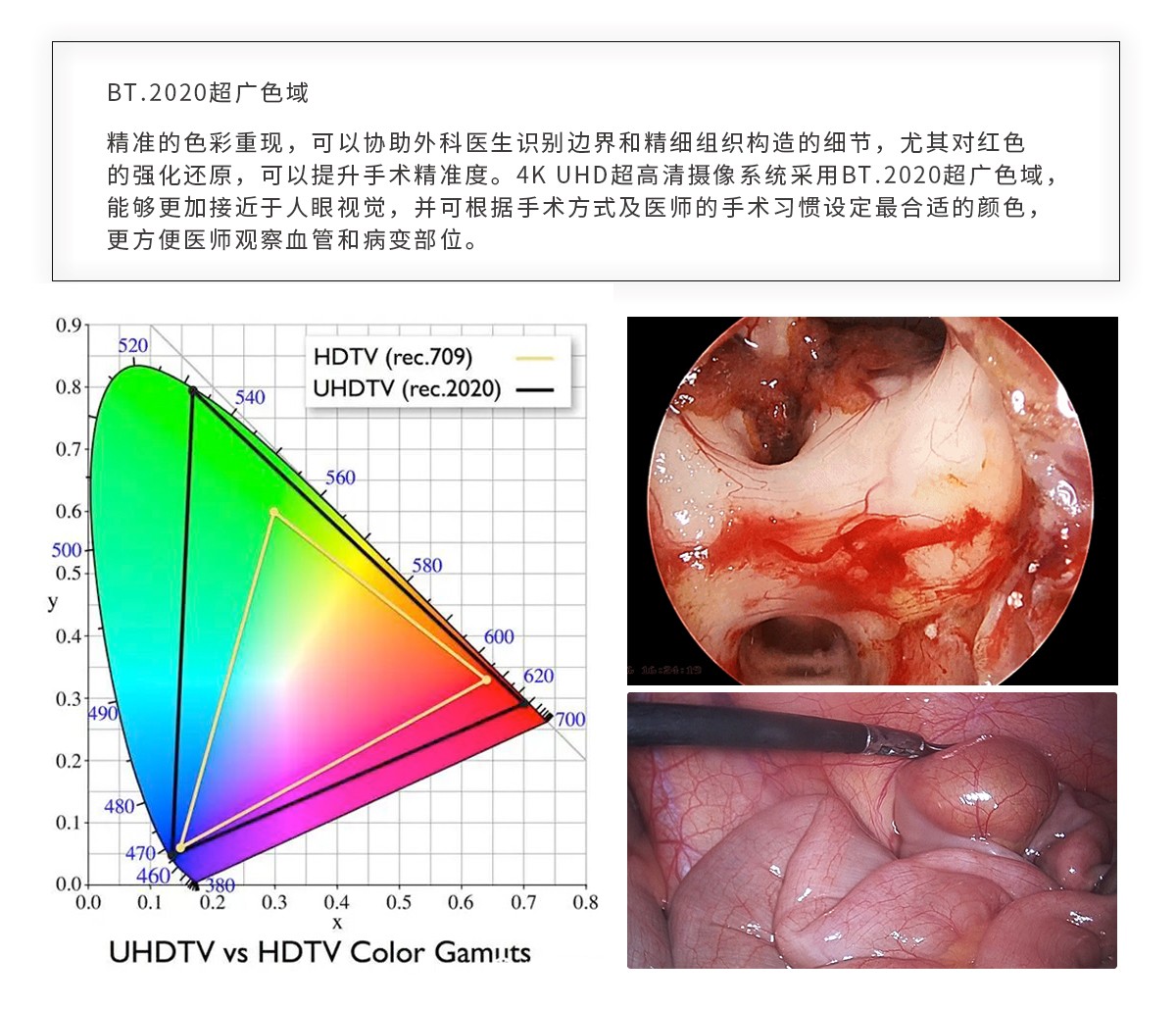 【4K醫(yī)用內(nèi)窺鏡攝像系統(tǒng)】您的第一臺(tái)“4K”找到了嗎？