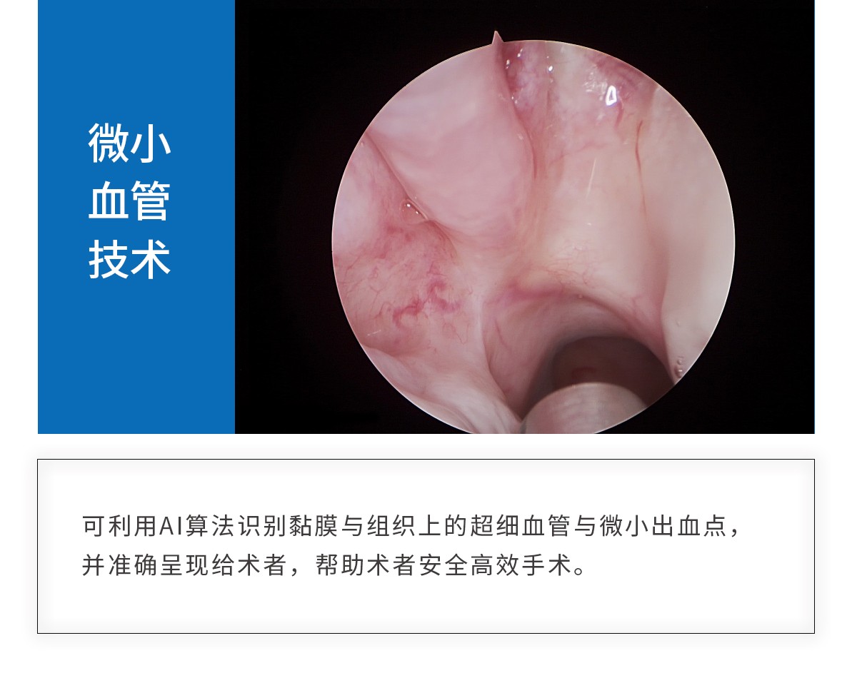 【4K醫(yī)用內(nèi)窺鏡攝像系統(tǒng)】您的第一臺(tái)“4K”找到了嗎？