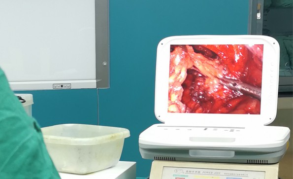 【腹腔鏡篇】腹腔鏡疝氣手術(shù)，您知道嗎？