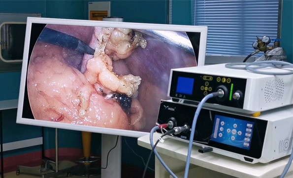 宮、腹腔鏡聯(lián)合手術在婦科的應用